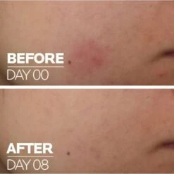 LA ROCHE-POSAY La Roche Posay Cicaplast B5 Serum Προσώπου Για Επανόρθωση & Ενυδάτωση, 30ml -Best Beauty Shop cicaplast serum 4